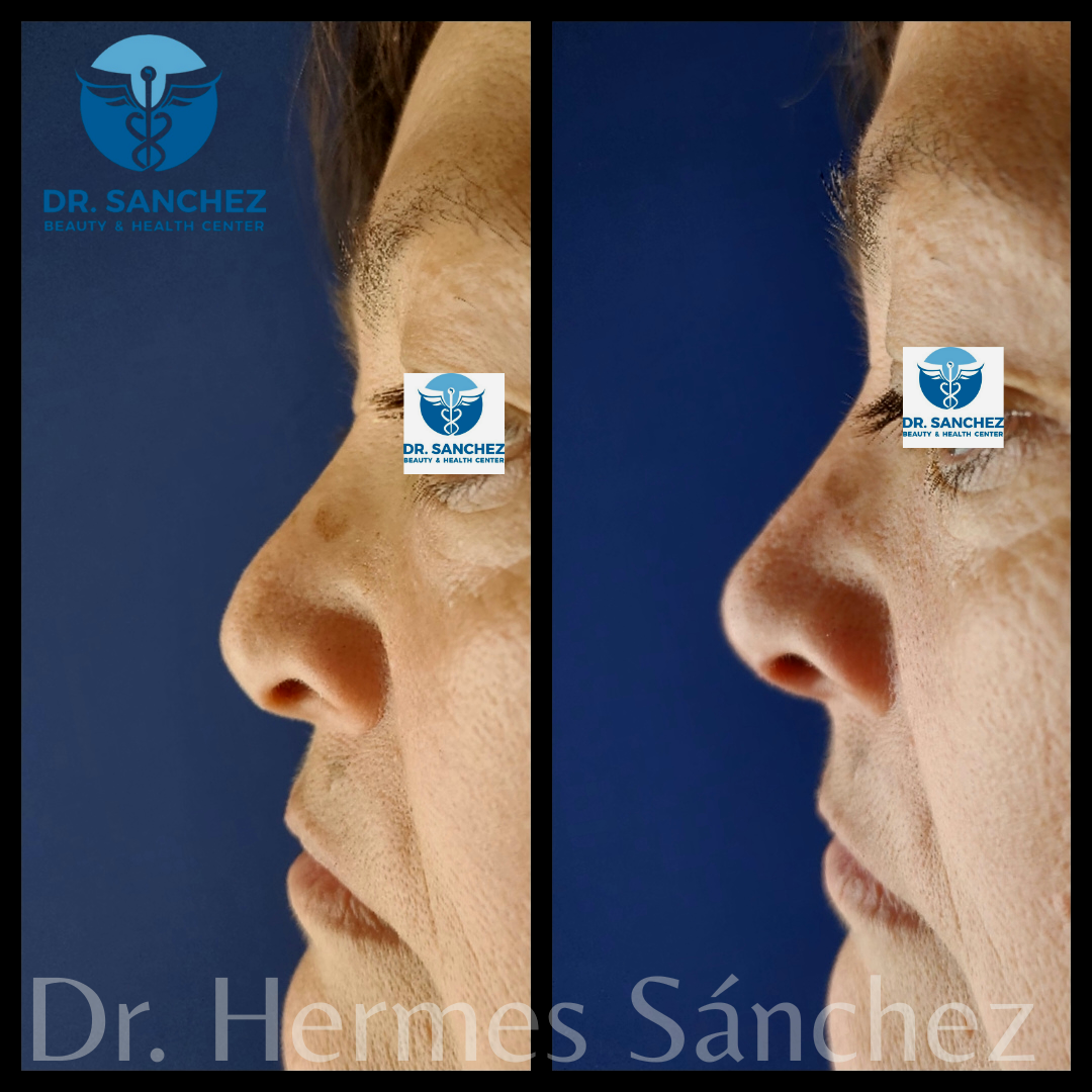 Galería - Transformación 8